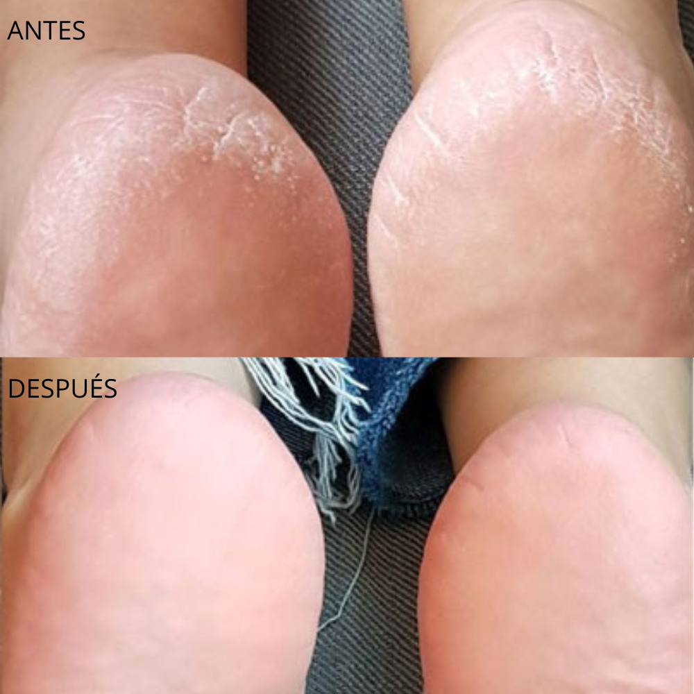 Lima de Pies Eléctrica Profesional | OptiStore™