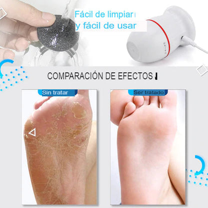 Confort Feet® | Lima Eléctrica para Pies